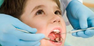 caries en los primeros dientes