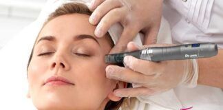 técnica del microneedling beneficios