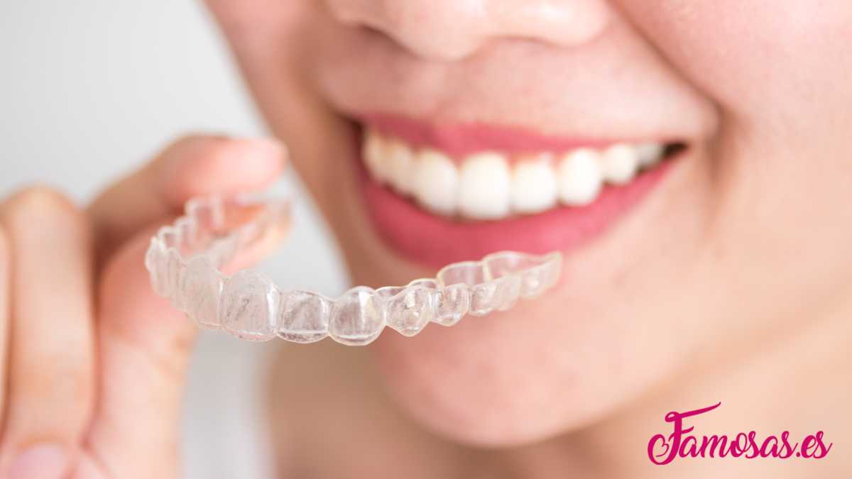 beneficios de la ortodoncia invisalign